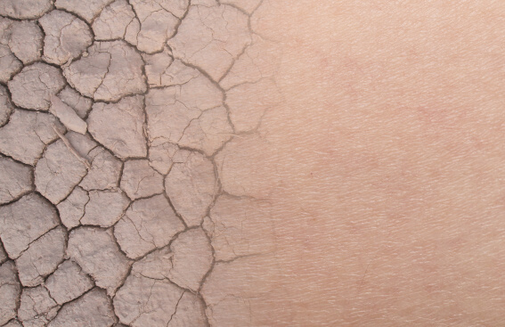 Comment prendre soin d'une peau sèche ?